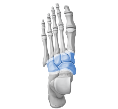 Mid Foot Arthritis Mid Foot Arthritis