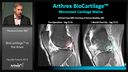 BioCartilage® in the Knee