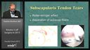 Rotator Cuff Surgery in 2013